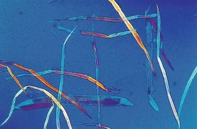 <p>Mikroskopibild av ca 1 mm långa björkfibrer.</p>
